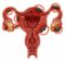 Ketahui Tentang Penyakit Endometriosis